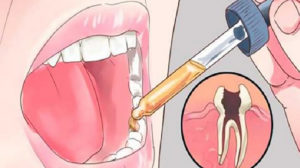 Scăpați de durerile de dinți cu acest remediu simplu!